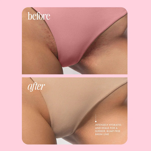 Bimini™ 2.0 - The Bump-Free Bikini Trimmer
